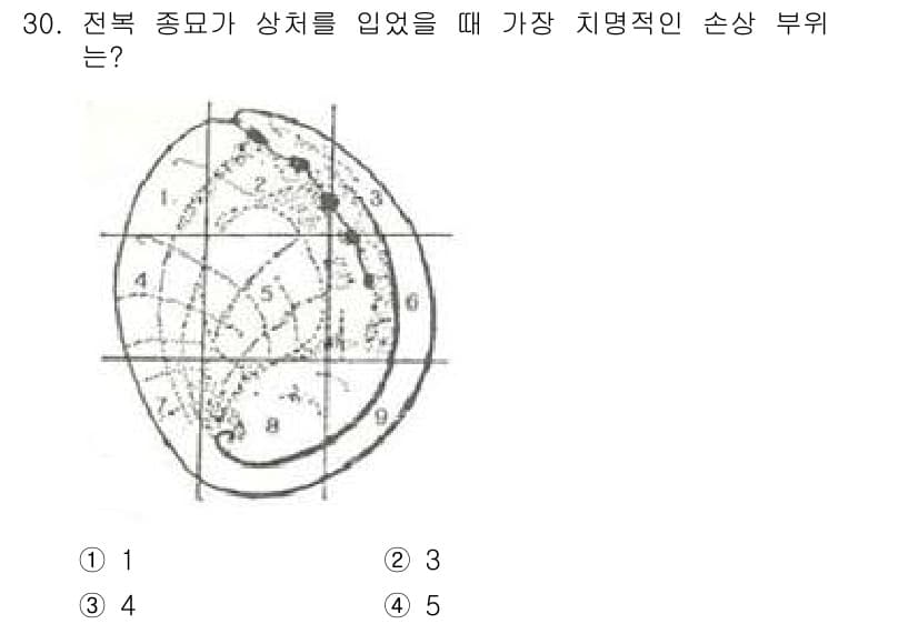 수산양식기사 2018년 30번 - 정답과 핵심 포인트를 검수 중인 기출문제