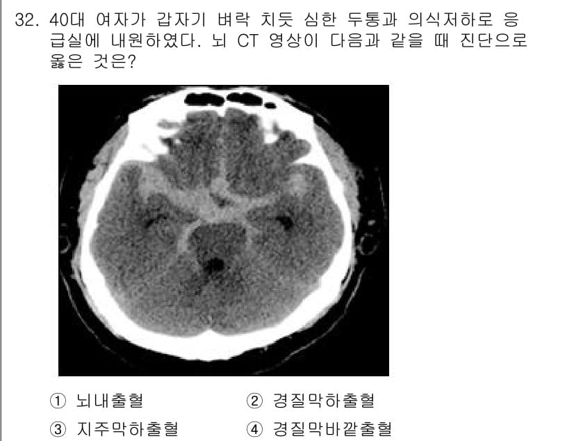 소방공무원(경력)_응급처치학개론 2024년 32번 - 정답과 핵심 포인트를 검수 중인 기출문제